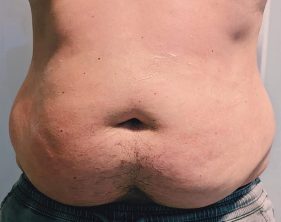 Vorher-Aufnahme Cryo-Metabolic, Zone Bauch