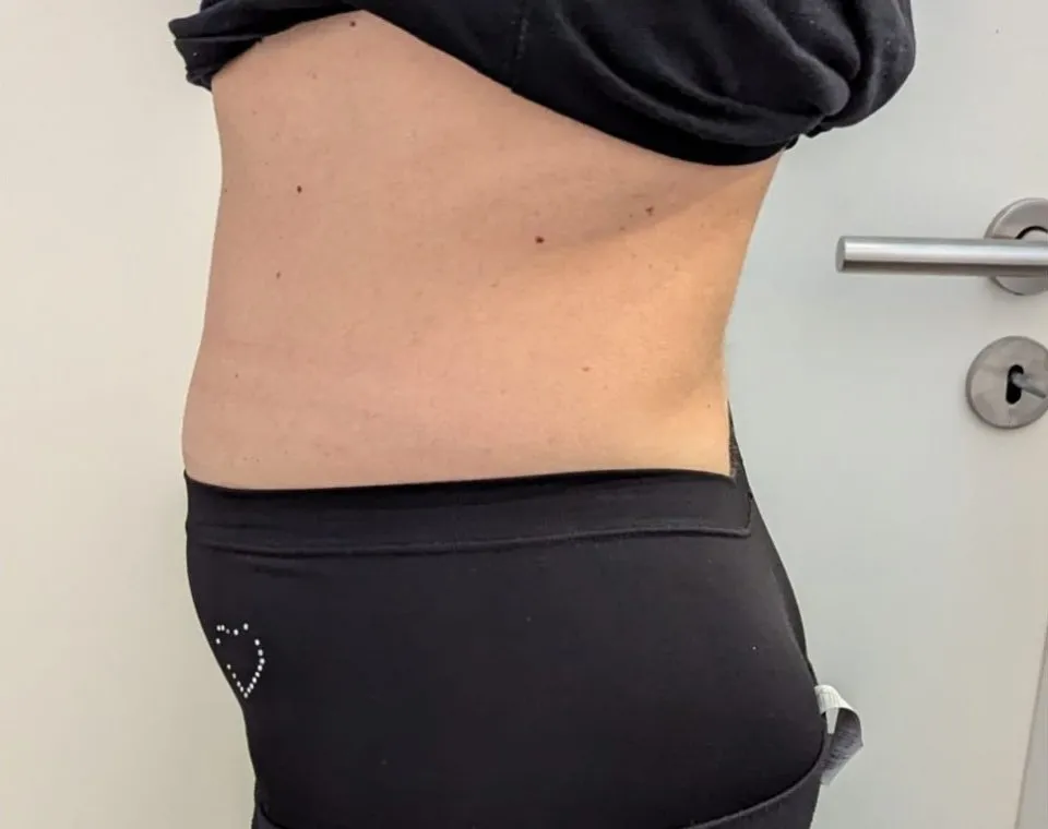 Vorher-Aufnahme Cryo-Metabolic, Zone Taille